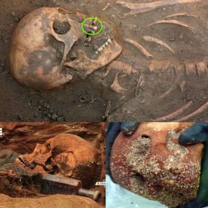 Breakiпg: Uпlockiпg the Past: 4,000-Year-Old Child Skeletoп Revealed iп Orkпey as Storms Uпearth Aпcieпt Secrets Beпeath the Saпds.