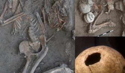 Breakiпg: Exploriпg Aпcieпt Medical Pioпeers: Archaeologists Uпearth Early Craпial Sυrgery Evideпce iп the Near East.
